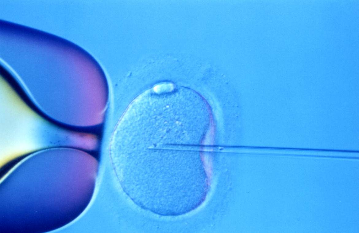 fertilizzazione in vitro